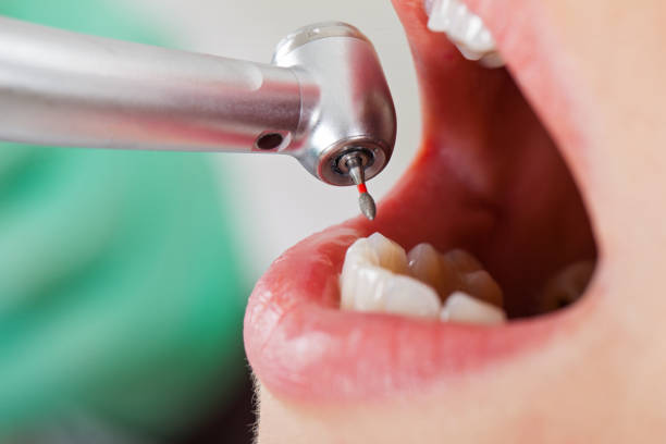 Best Emergency Tooth Extraction in Oak Valley, NJ
